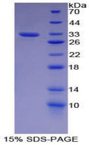 Figure 1. SDS-PAGE