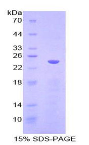 Figure 1. SDS-PAGE