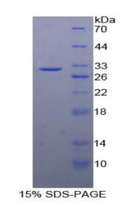 Figure 1. SDS-PAGE
