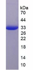 Figure 3. SDS-PAGE