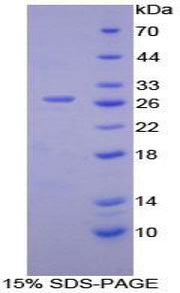 Figure 1. SDS-PAGE