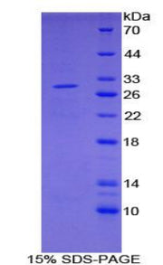 Figure 1. SDS-PAGE
