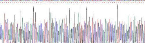 Recombinant Rat Calpain 1 (CAPN1)