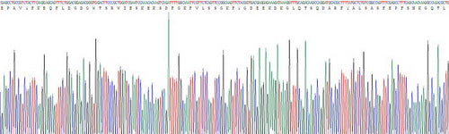 Recombinant Human Calreticulin (CALR)