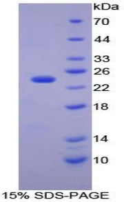 Figure 1. SDS-PAGE