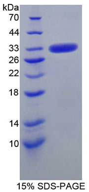 Figure 1. SDS-PAGE