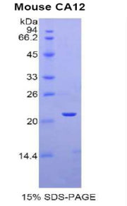 Figure 1. SDS-PAGE