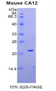 Figure 1. SDS-PAGE