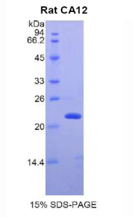 Figure 1. SDS-PAGE