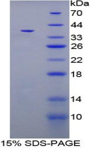 Figure 1. SDS-PAGE