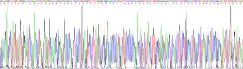 Recombinant Human Carcinoembryonic Antigen (CEA)