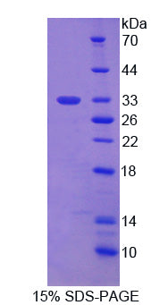 Figure 1. SDS-PAGE