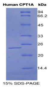 Figure 1. SDS-PAGE