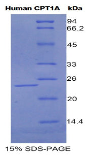 Figure 1. SDS-PAGE