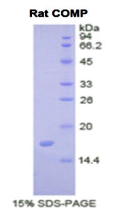 Figure 1. SDS-PAGE