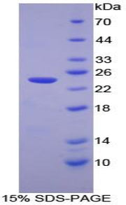 Figure 1. SDS-PAGE