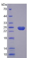 Figure 2. SDS-PAGE