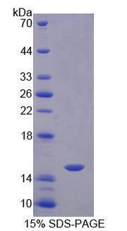 Figure 1. SDS-PAGE
