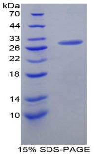 Figure 1. SDS-PAGE