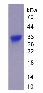 Figure 1. SDS-PAGE