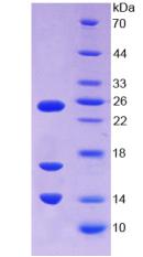 Figure 3. SDS-PAGE