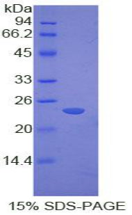 Figure 1. SDS-PAGE