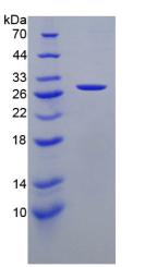 Figure 2. SDS-PAGE