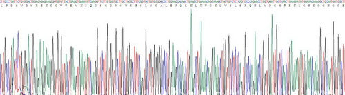 Recombinant Human Cathepsin S (CTSS)