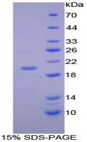 Figure 1. SDS-PAGE