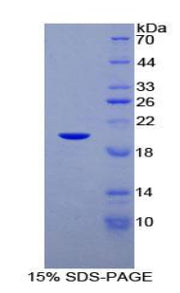 Figure 1. SDS-PAGE