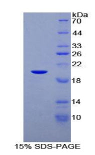 Figure 1. SDS-PAGE