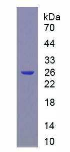 Figure 1. SDS-PAGE