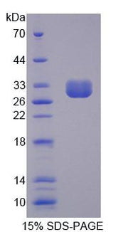 Figure 1. SDS-PAGE