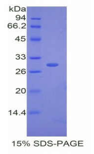 Figure 1. SDS-PAGE