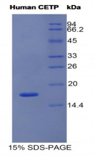 Figure 1. SDS-PAGE