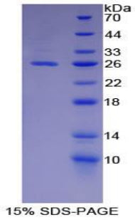 Figure 1. SDS-PAGE