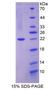 Figure 1. SDS-PAGE