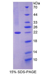 Figure 1. SDS-PAGE