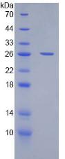 Figure 2. SDS-PAGE