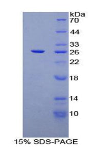 Figure 1. SDS-PAGE