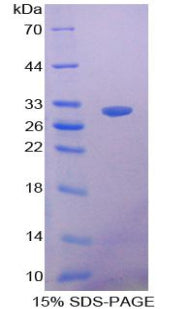 Figure 1. SDS-PAGE