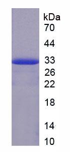 Figure 2. SDS-PAGE
