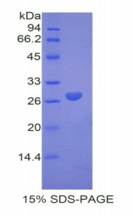 Figure 1. SDS-PAGE