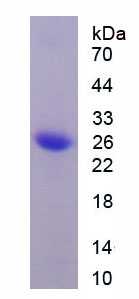 Figure 1. SDS-PAGE
