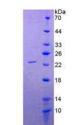Figure 2. SDS-PAGE