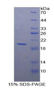 Figure 1. SDS-PAGE