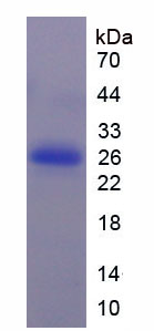 Figure 1. SDS-PAGE