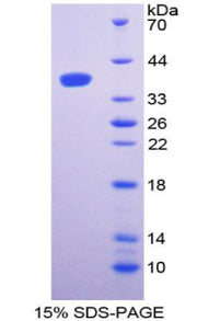 Figure 1. SDS-PAGE