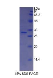 Figure 1. SDS-PAGE