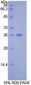 Figure 1. SDS-PAGE